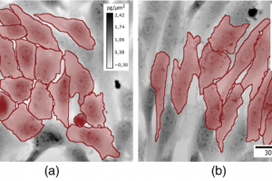 Published paper "Automated interpretation of time-lapse quantitative phase image by machine learning to study cellular dynamics during epithelial–mesenchymal transition"